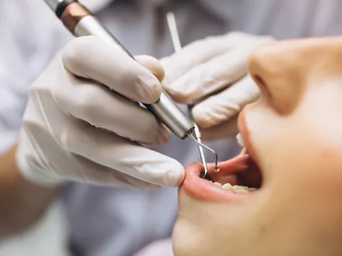 A hygienist cleaning a patient's lower teeth with a dental scaler